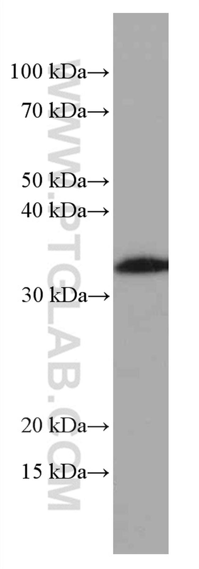 OLIG2 Antibody in Western Blot (WB)