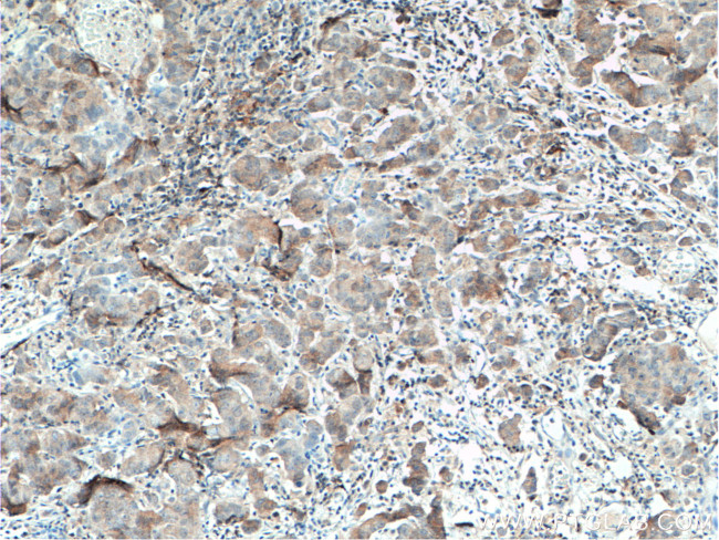 USP7 Antibody in Immunohistochemistry (Paraffin) (IHC (P))