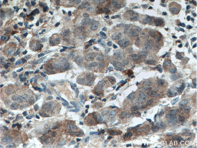 USP7 Antibody in Immunohistochemistry (Paraffin) (IHC (P))