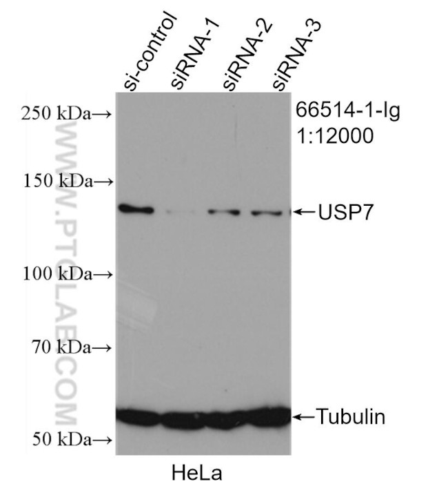 USP7 Antibody in Western Blot (WB)