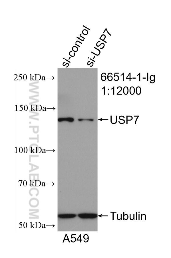 USP7 Antibody in Western Blot (WB)