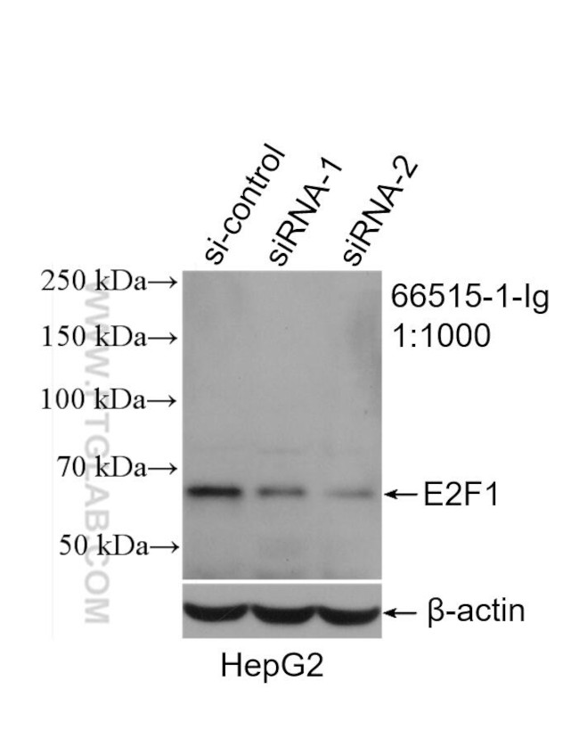 E2F1 Antibody in Western Blot (WB)