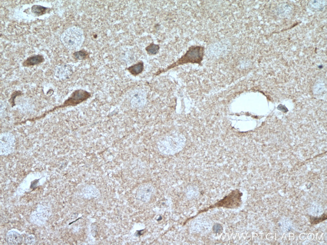 MKS1 Antibody in Immunohistochemistry (Paraffin) (IHC (P))