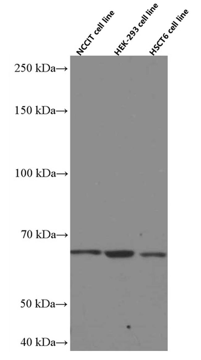 MKS1 Antibody in Western Blot (WB)