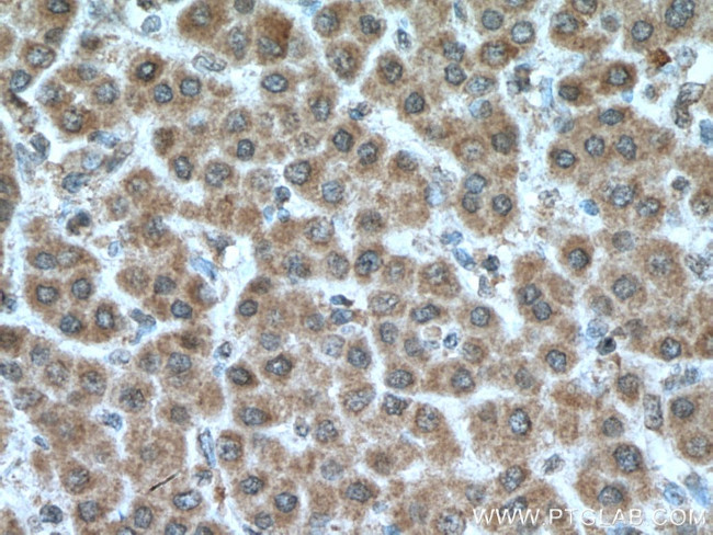 MKS1 Antibody in Immunohistochemistry (Paraffin) (IHC (P))