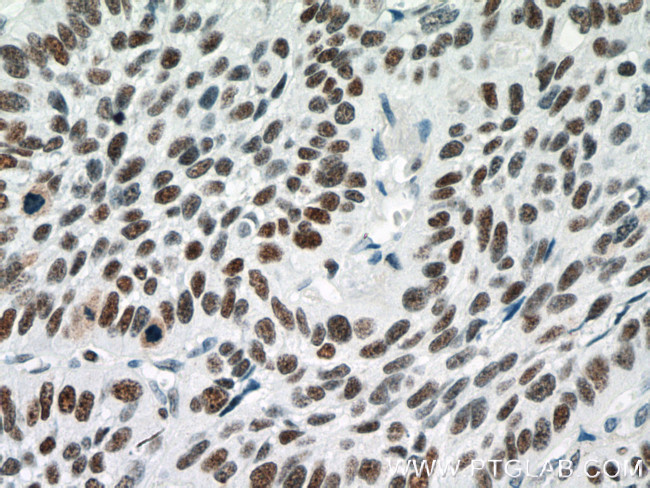 PARP1 Antibody in Immunohistochemistry (Paraffin) (IHC (P))