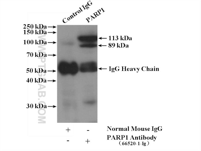 PARP1 Antibody in Immunoprecipitation (IP)