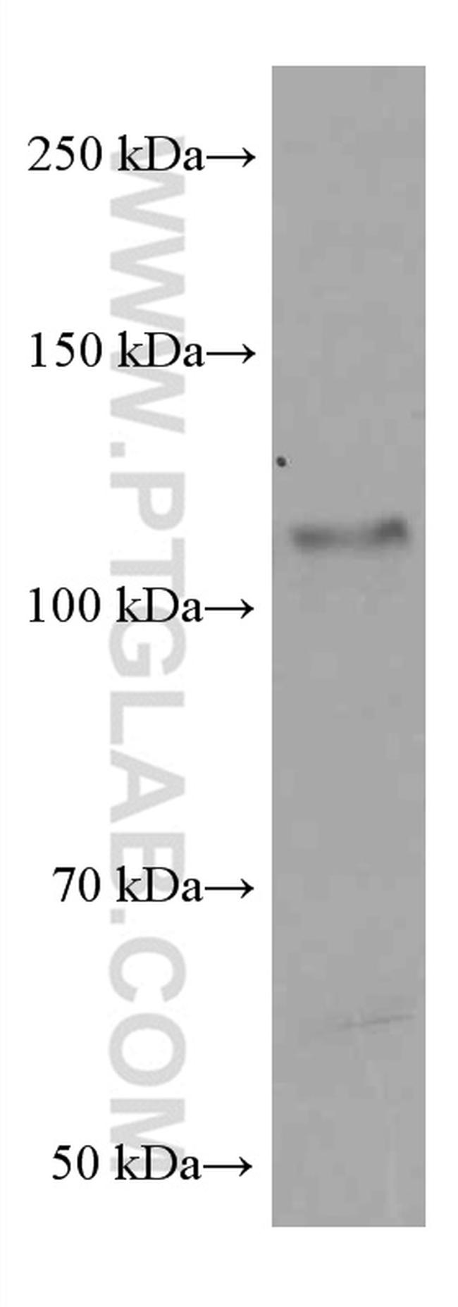 PARP1 Antibody in Western Blot (WB)