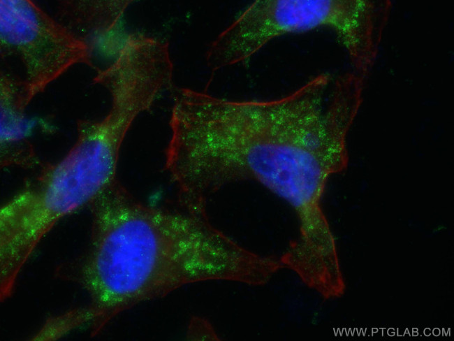 TIP47 Antibody in Immunocytochemistry (ICC/IF)