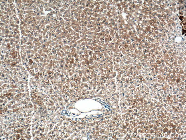 TIP47 Antibody in Immunohistochemistry (Paraffin) (IHC (P))