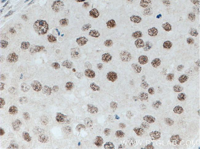 HMGB1 Antibody in Immunohistochemistry (Paraffin) (IHC (P))