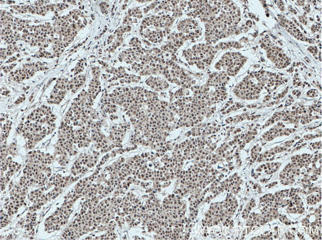 HMGB1 Antibody in Immunohistochemistry (Paraffin) (IHC (P))