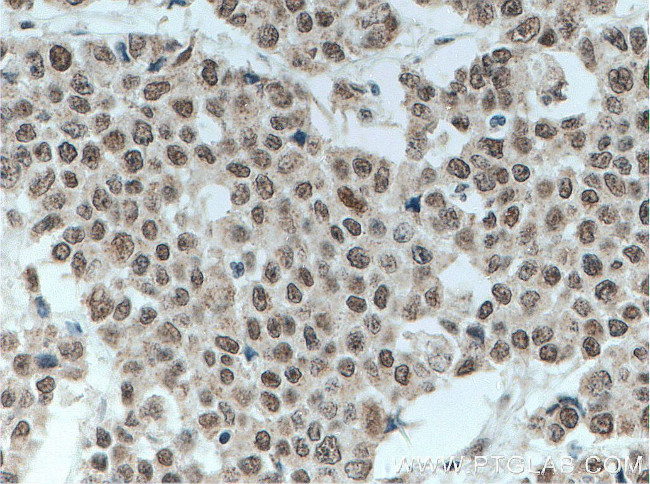 HMGB1 Antibody in Immunohistochemistry (Paraffin) (IHC (P))