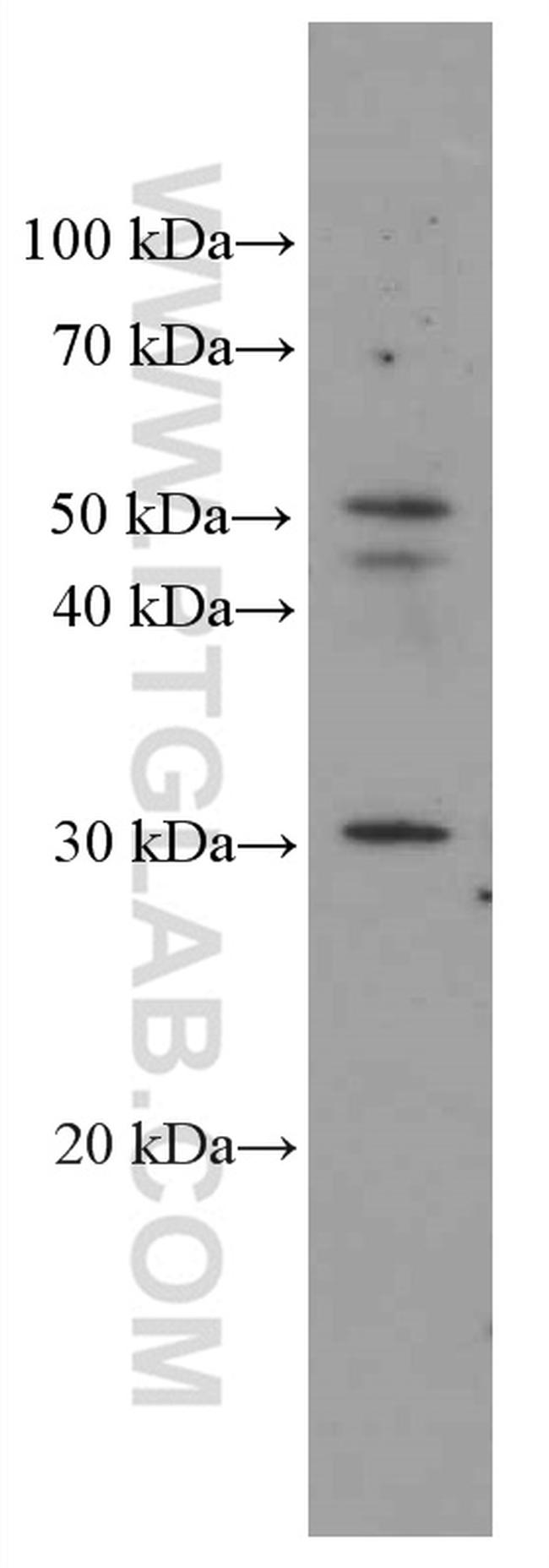 HMGB1 Antibody in Western Blot (WB)