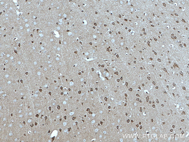 MFF Antibody in Immunohistochemistry (Paraffin) (IHC (P))