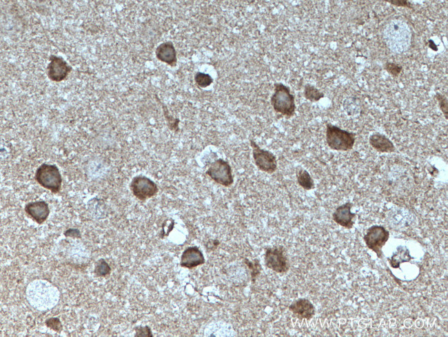 MFF Antibody in Immunohistochemistry (Paraffin) (IHC (P))