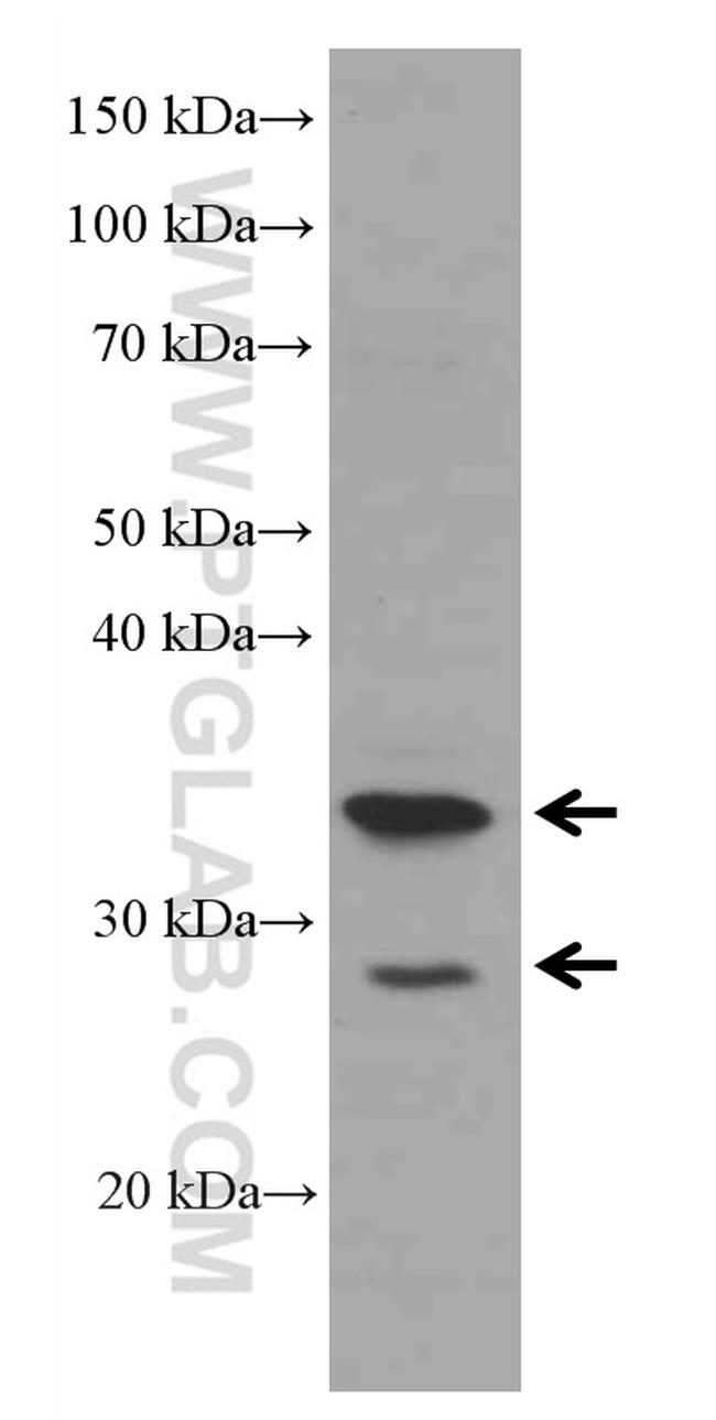 MFF Antibody in Western Blot (WB)