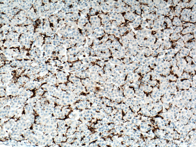 FCGR2A / CD32a Antibody in Immunohistochemistry (Paraffin) (IHC (P))