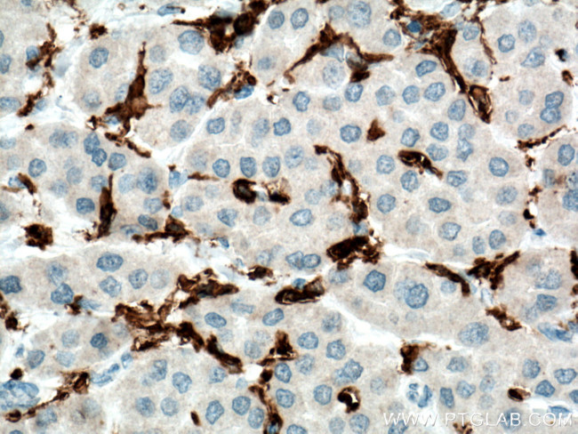 FCGR2A / CD32a Antibody in Immunohistochemistry (Paraffin) (IHC (P))
