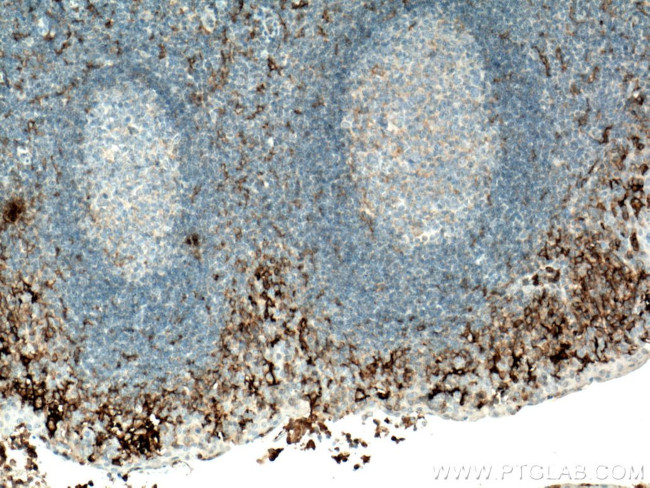 FCGR2A / CD32a Antibody in Immunohistochemistry (Paraffin) (IHC (P))