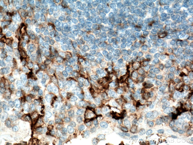 FCGR2A / CD32a Antibody in Immunohistochemistry (Paraffin) (IHC (P))