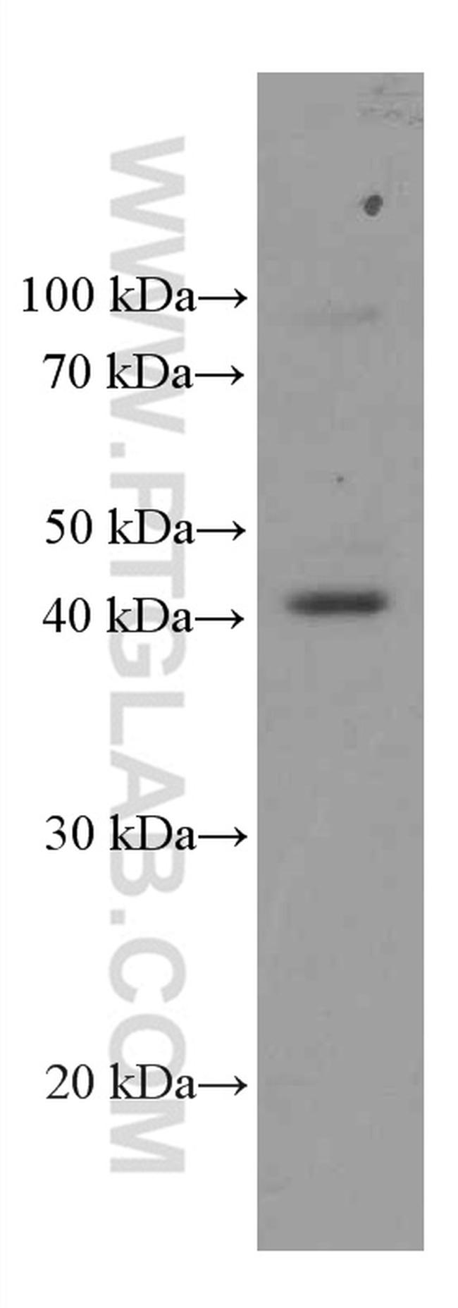 FCGR2A / CD32a Antibody in Western Blot (WB)