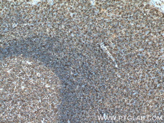 HLA-E Antibody in Immunohistochemistry (Paraffin) (IHC (P))