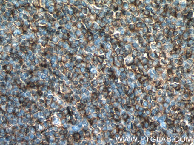 HLA-E Antibody in Immunohistochemistry (Paraffin) (IHC (P))