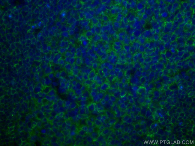 HLA-E Antibody in Immunohistochemistry (PFA fixed) (IHC (PFA))