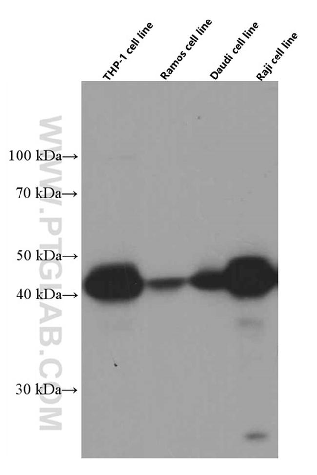 HLA-E Antibody in Western Blot (WB)