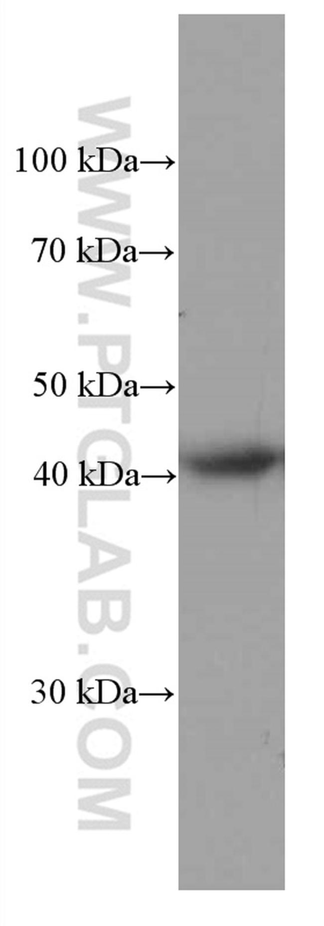 HLA-E Antibody in Western Blot (WB)