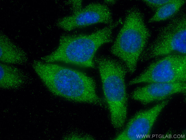 Cathepsin D Antibody in Immunocytochemistry (ICC/IF)