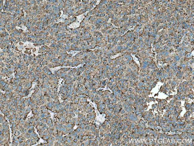 Cathepsin D Antibody in Immunohistochemistry (Paraffin) (IHC (P))