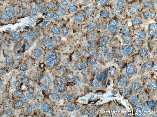 Cathepsin D Antibody in Immunohistochemistry (Paraffin) (IHC (P))