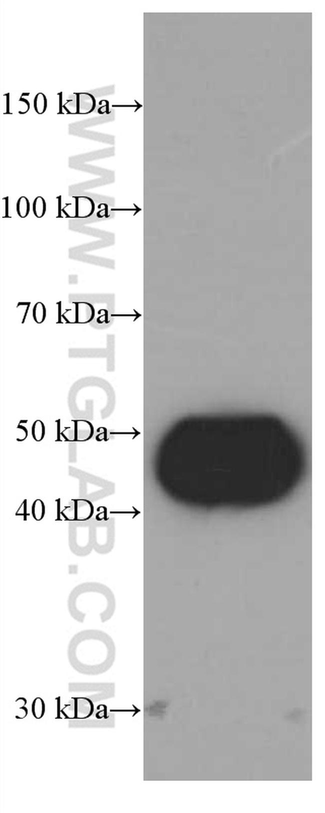 Cathepsin D Antibody in Western Blot (WB)