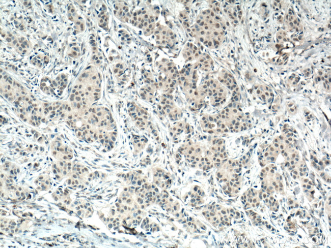 AMPK alpha Antibody in Immunohistochemistry (Paraffin) (IHC (P))