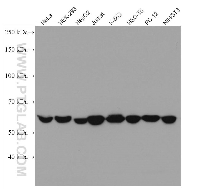 AMPK alpha Antibody in Western Blot (WB)