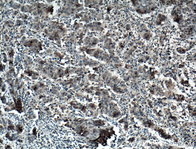 AMPK alpha Antibody in Immunohistochemistry (Paraffin) (IHC (P))