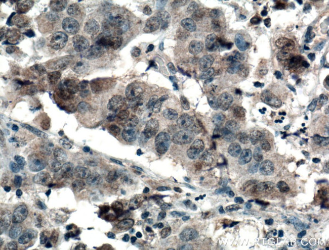 AMPK alpha Antibody in Immunohistochemistry (Paraffin) (IHC (P))