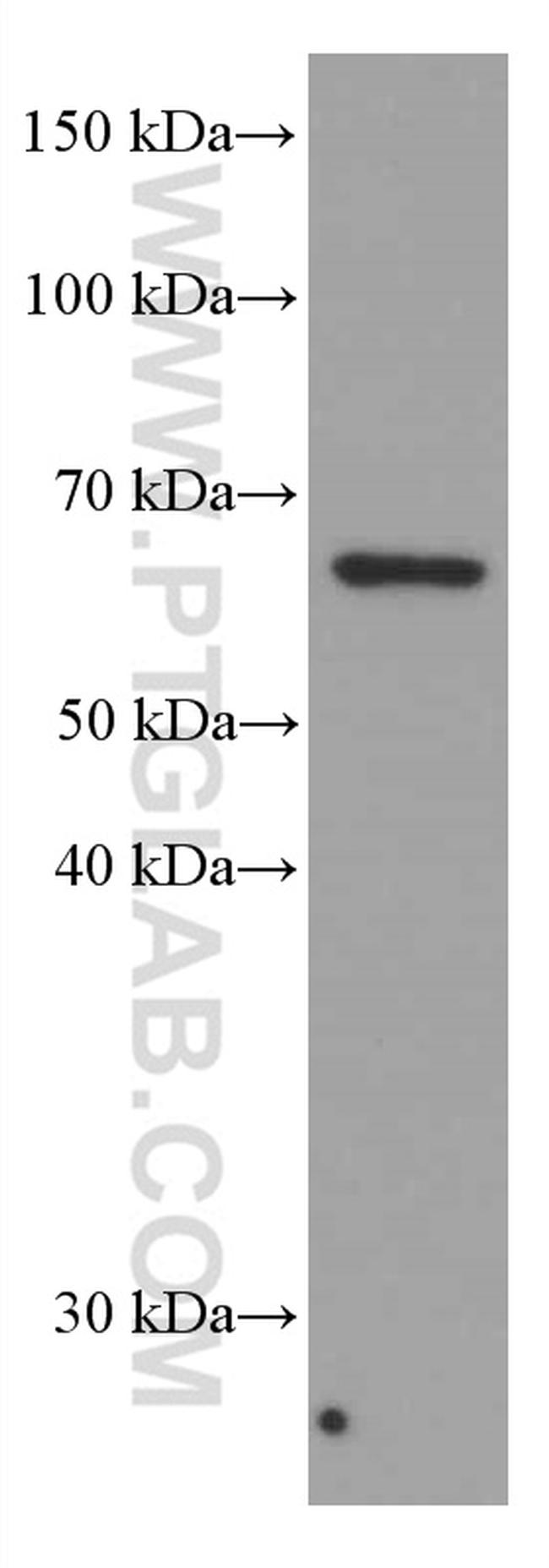 AMPK alpha Antibody in Western Blot (WB)