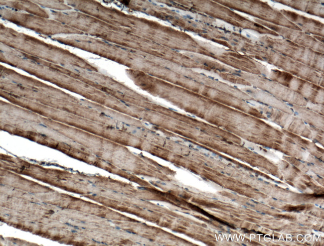 RYR1 Antibody in Immunohistochemistry (Paraffin) (IHC (P))