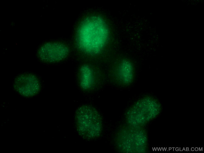 TOP2A Antibody in Immunocytochemistry (ICC/IF)