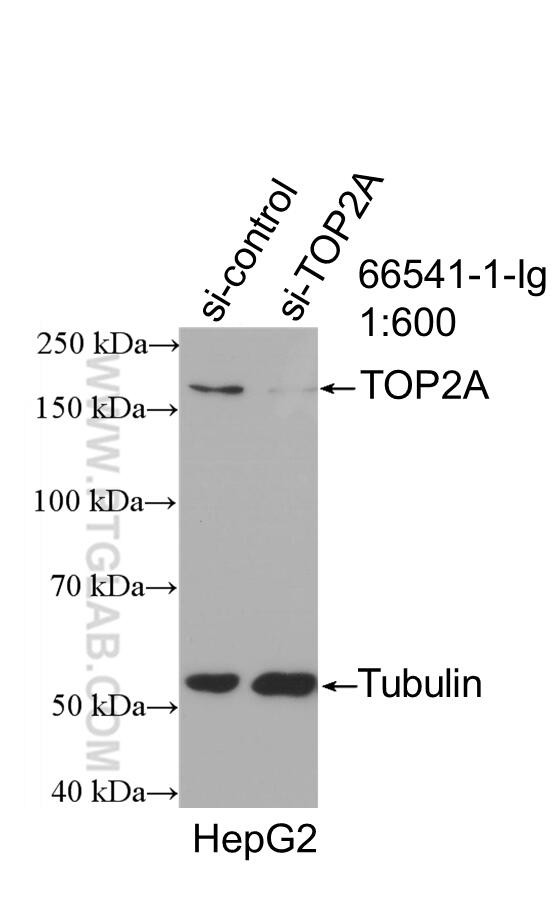 TOP2A Antibody in Western Blot (WB)