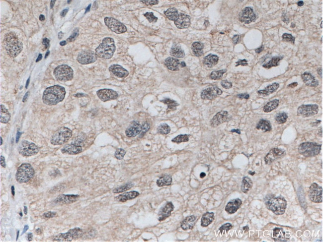 TOP2A Antibody in Immunohistochemistry (Paraffin) (IHC (P))