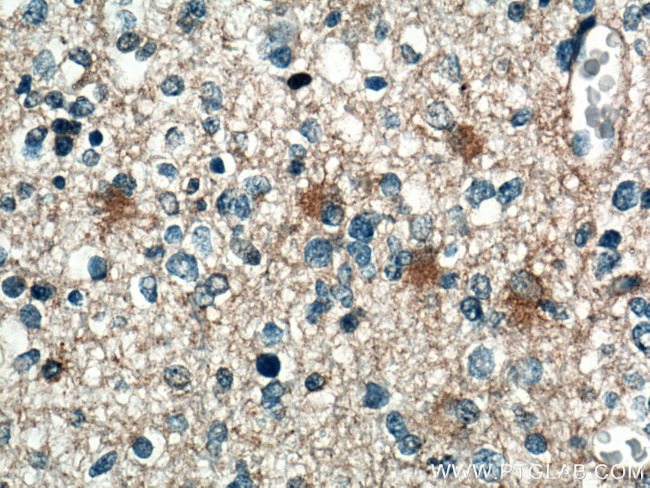 SEPT7 Antibody in Immunohistochemistry (Paraffin) (IHC (P))