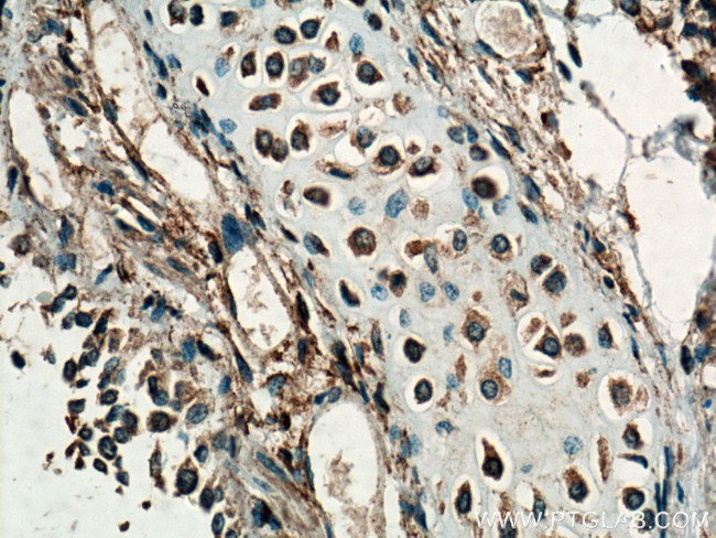 SEPT7 Antibody in Immunohistochemistry (Paraffin) (IHC (P))