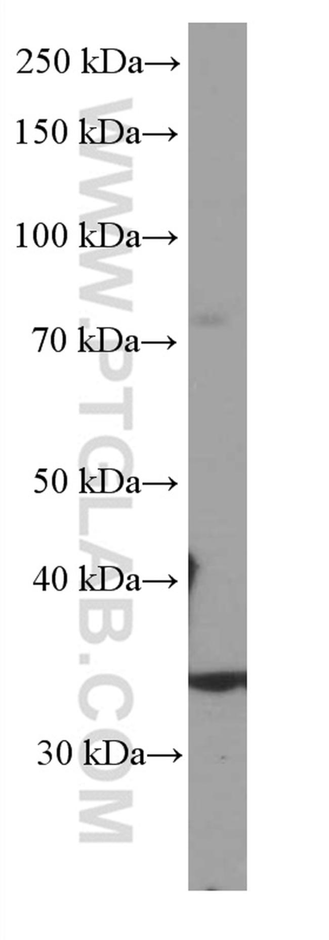 SIRT4 Antibody in Western Blot (WB)