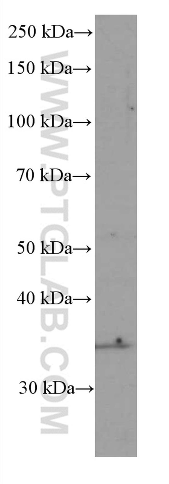 SIRT4 Antibody in Western Blot (WB)