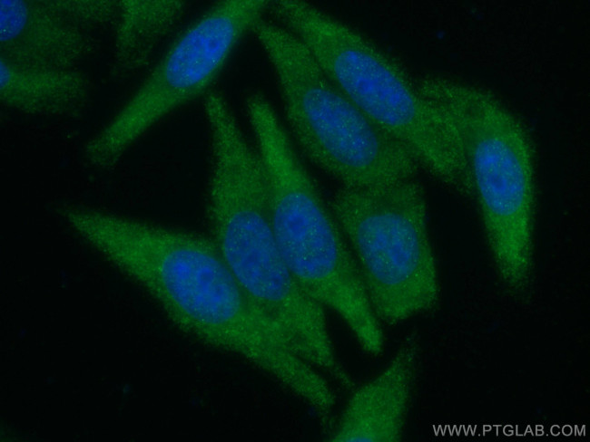 TWIST2 Antibody in Immunocytochemistry (ICC/IF)