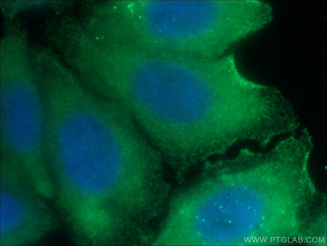 TWIST2 Antibody in Immunocytochemistry (ICC/IF)